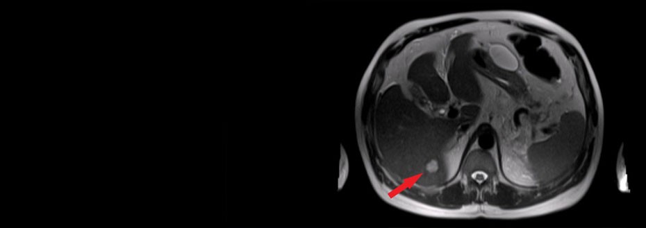 Medical Image Annotation and Tagging Services