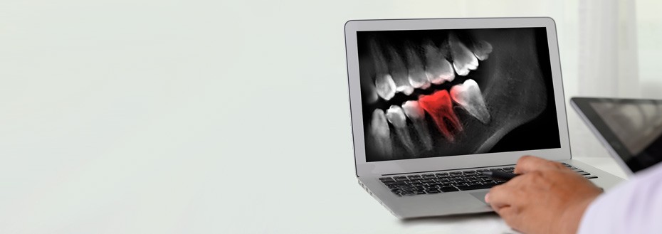Dental X-Ray Imaging Services