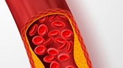 Anticoagulation Management