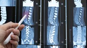 Spinal MRI Interpretation