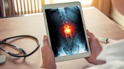 Medical Animations