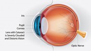 Retina Illustration