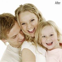 Image Enhancement Services