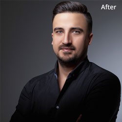 Headshot Correction After