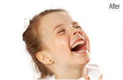 Image Enhancement Services