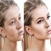 Photoshop Image Cleansing Services Photoshop Image Cleansing Services