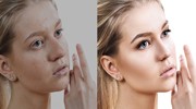 Image Cleaning