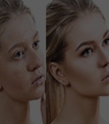 Photoshop Image Cleansing Services