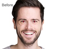 Red-eye Removal Before