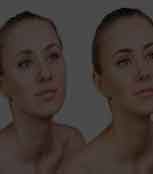 Skin Retouching Services