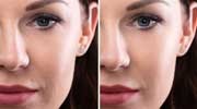 Skin Retouching Such as Suntans, Complexion Manipulation Skin Retouching Such as Suntans, Complexion Manipulation